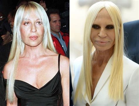 donatella versace operacje plastyczne|Donatella Versace, Before and After .